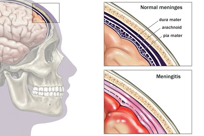 http://mednorge.com/wp-content/uploads/2020/12/1800ss_medicalimages_rm_brain_meninges_illustration.jpg