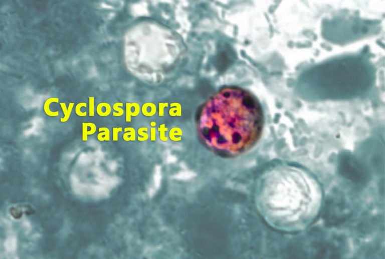 Cyclospora-infeksjon: symptomer, årsaker og behandling