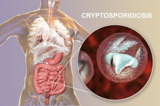Cryptosporidium-infeksjon: symptomer og behandling
