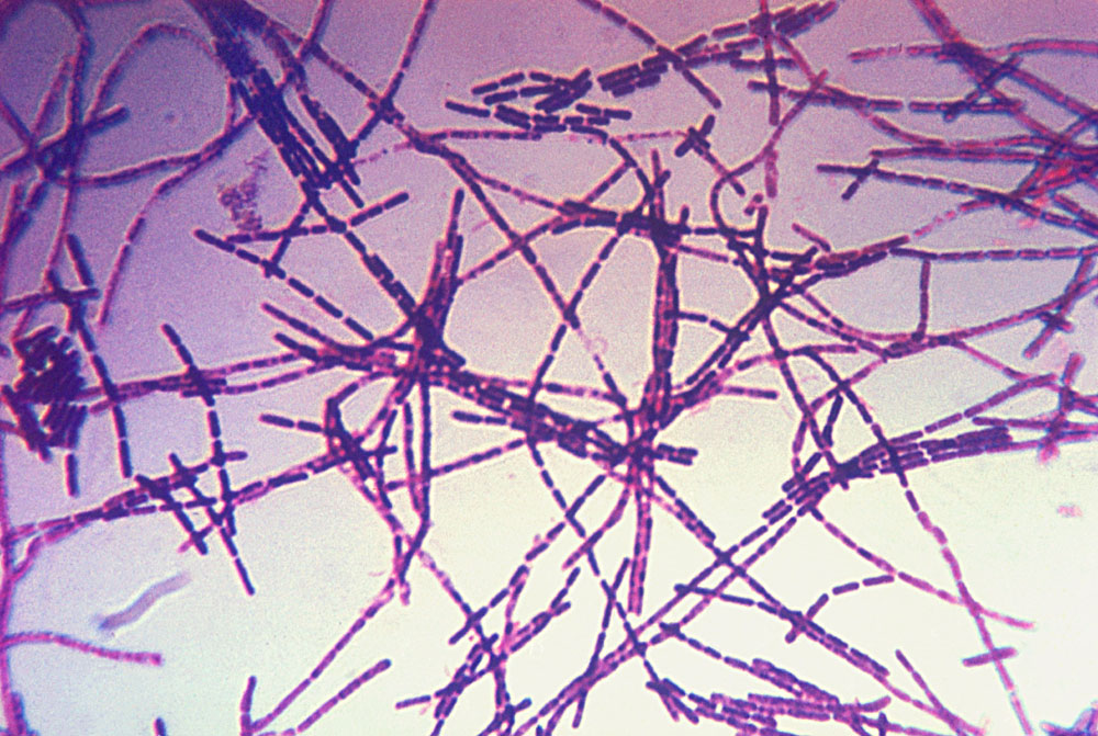 Bacillus anthracis bakterie
