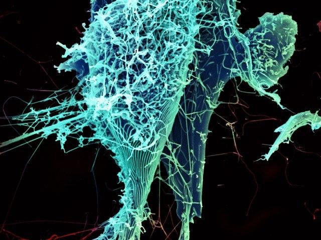 Ebola-viruspartikler