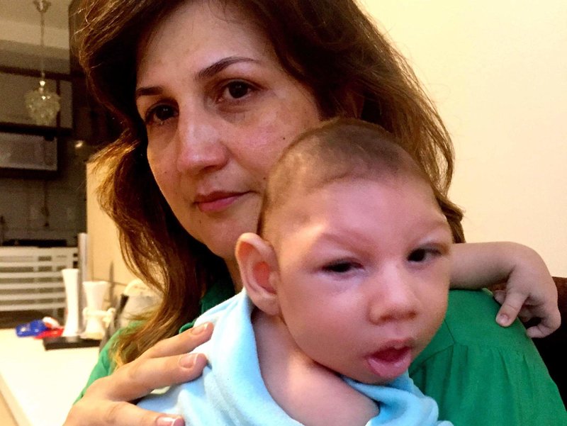 Marilla Lima, en brasiliansk mor, hadde Zika-virus mens hun var gravid.  Hennes 2,5 måneder gamle sønn, Arthur, har mikrocefali - en fødselsskade preget av et lite hode og alvorlig hjerneskade. 
