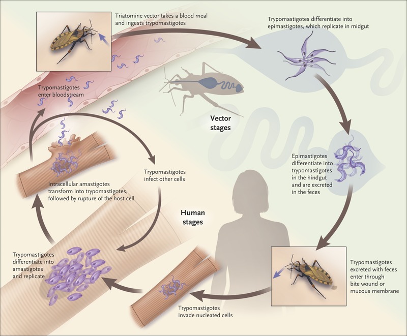 http://mednorge.com/wp-content/uploads/2021/01/nejmra1410150_f1.jpeg