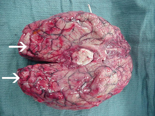 Omfattende blødning og nekrose er tilstede i hjernen, hovedsakelig i frontal cortex.